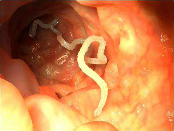 ما هو شكل الدودة الشريطية